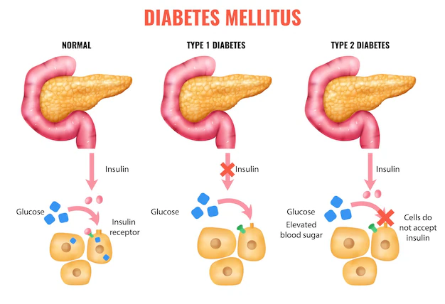 Insulin: Ključna uloga u upravljanju nivoima šećera u krvi
